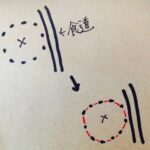 カテーテルアブレーション当日（入院2日目）